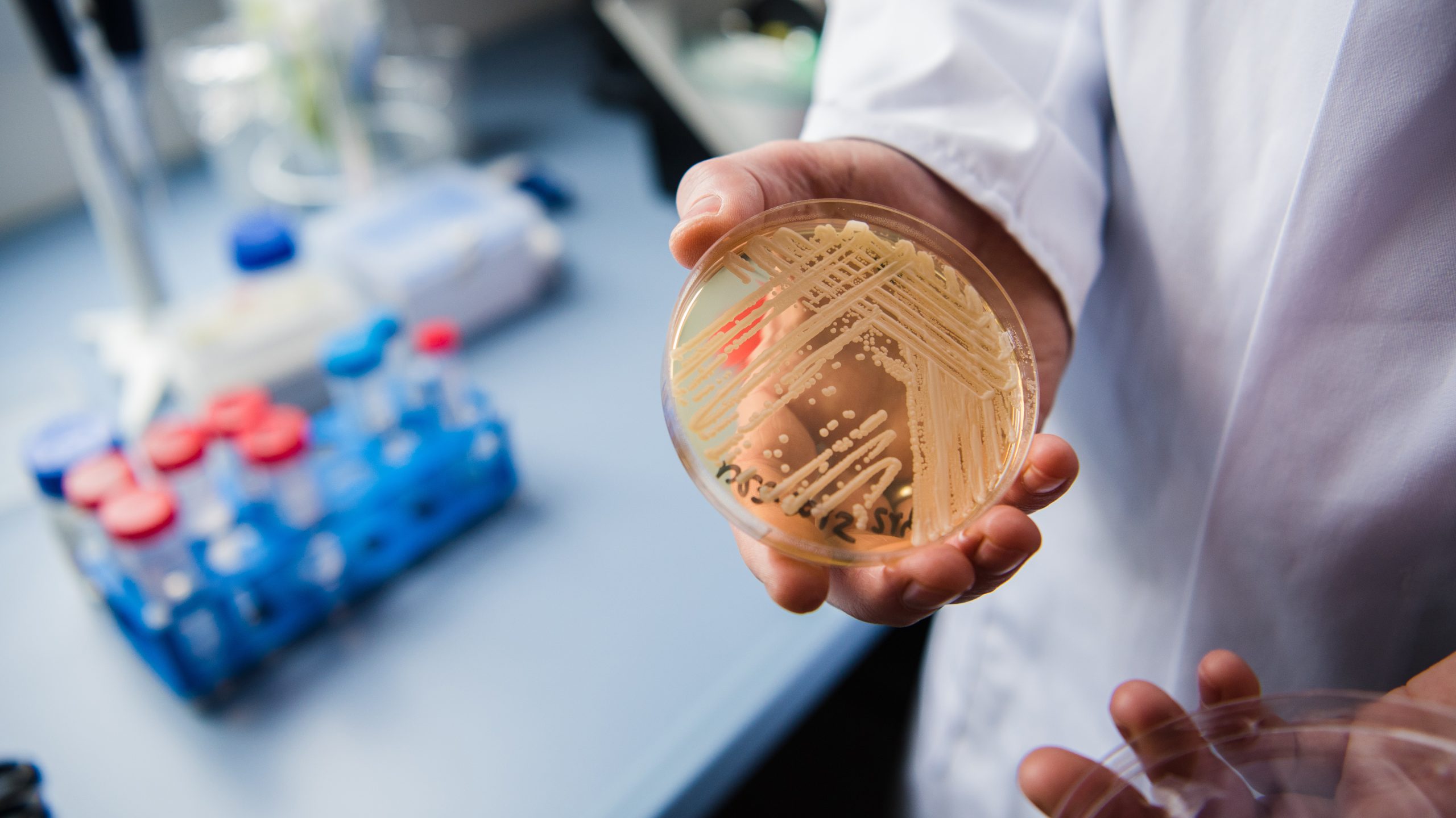 New study reveals why dangerous fungus is so difficult to treat — KTVU FOX 2 Bay Area, San Rafael Community news